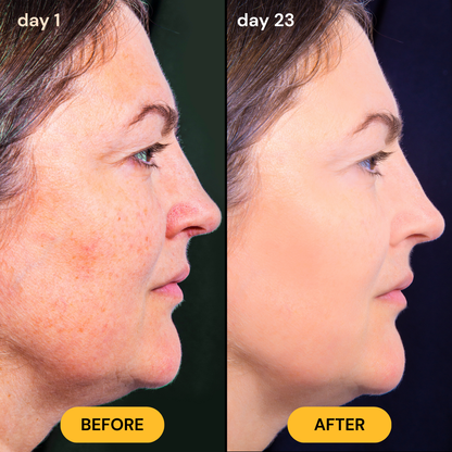 HoneyGlow™ Skin Repair Balm